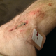 Illustration for article titled Bike crash aftermath pics, blood warning